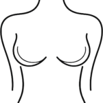 Mastopexia con Implantes