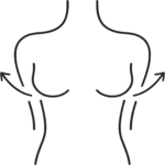 Mamoplastia de Aumento