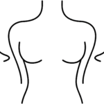 Mamoplastia Reductora